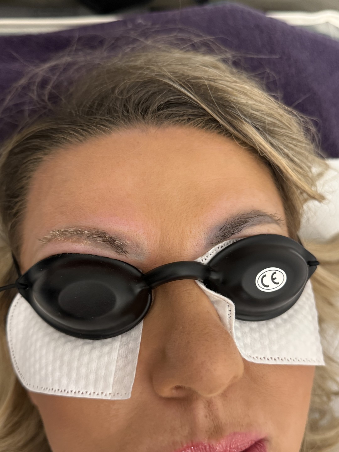 Beauty studio Luxe #sarajevo Laserska epilacija Lasersko skidanje tetovaza mala tetovaza