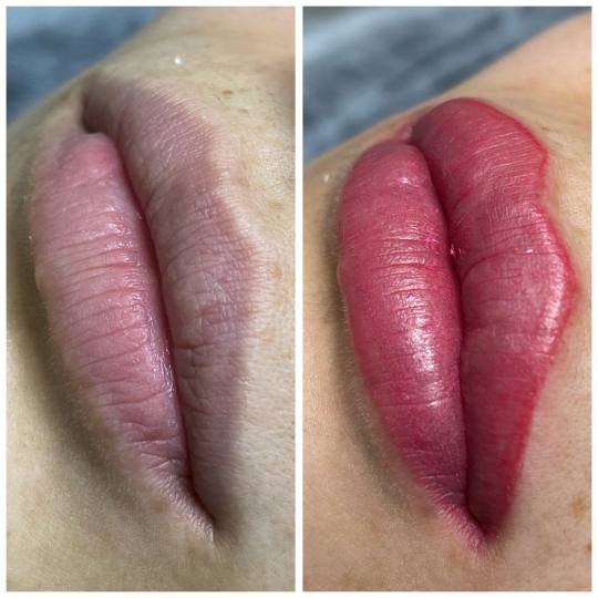 Poezija ljepote #sarajevo Trajna šminka Trajna šminka - usne