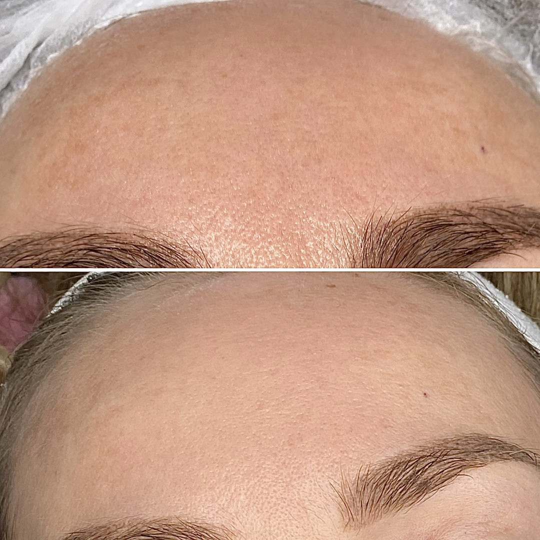 Paket tretmana za kožu u 30- im i 40-im - Fabrika ljepote, Sarajevo Tretmani tijela Tijelo Tretmani tijela, Sarajevo, Istočno Sarajevo