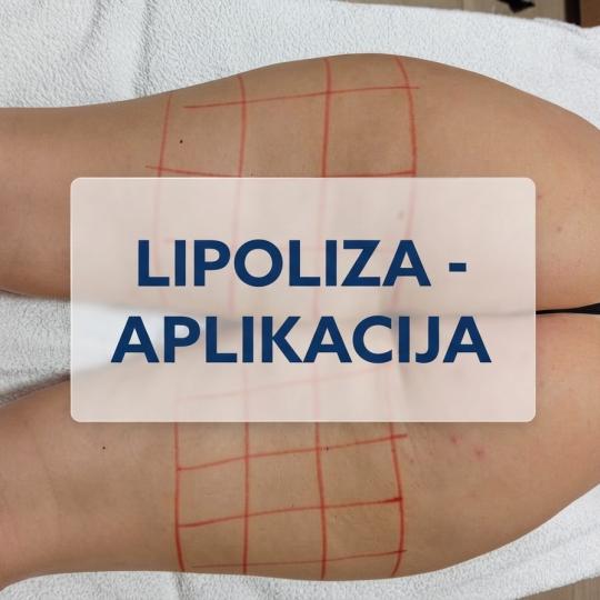 Enjoy Salona usluga