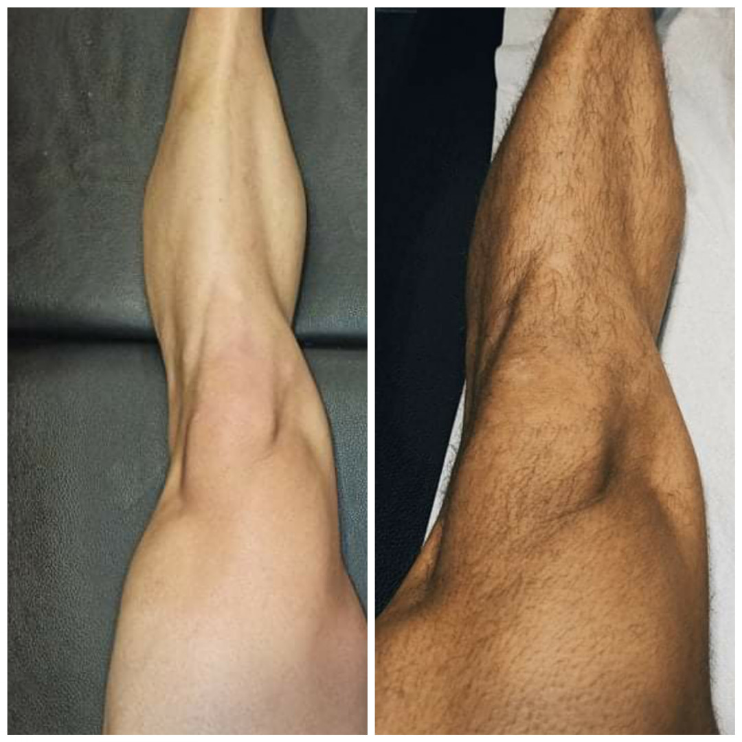 Kuća ljepote Djenna #sarajevo Depilacija šećernom pastom Depilacija nogu šećernom pastom