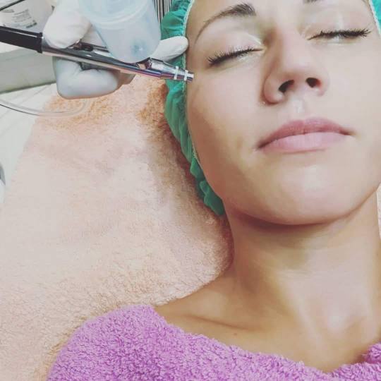 ABC Cosmetic #sarajevo Tretman lica Oksigen tretman lica