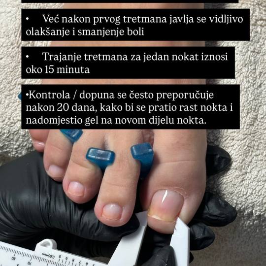Uljepšaj se #sarajevo Medicinski pedikir Liftup gel - urasli nokat