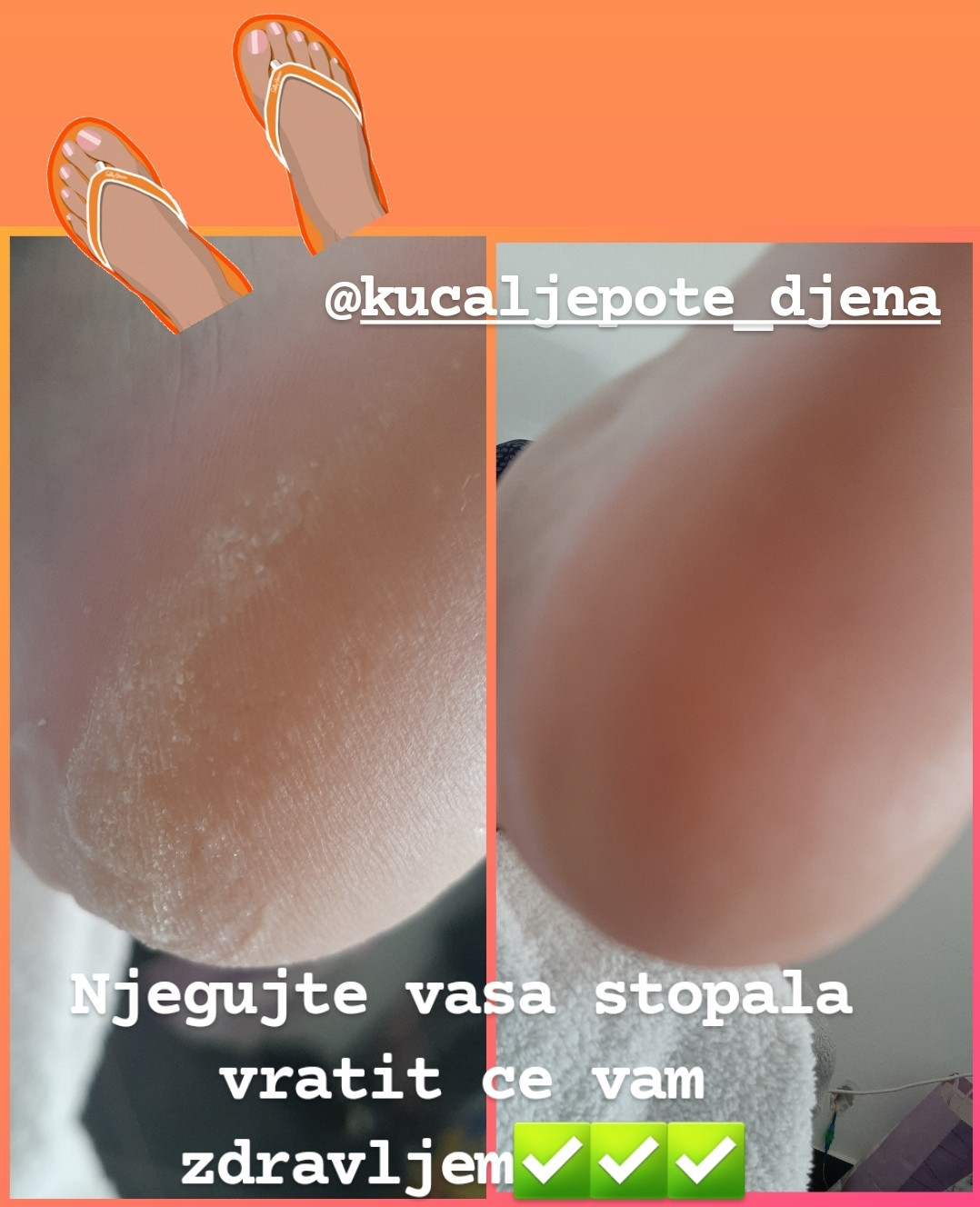 Kuća ljepote Djenna #sarajevo Estetski pedikir Callux pedikir