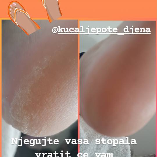 Kuća ljepote Djenna #sarajevo Estetski pedikir Callux pedikir