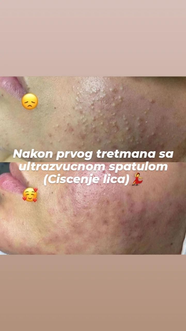 Poezija ljepote #sarajevo Farbanje kose Čišćenje lica + zlatne srebrne niti + maska + masaža