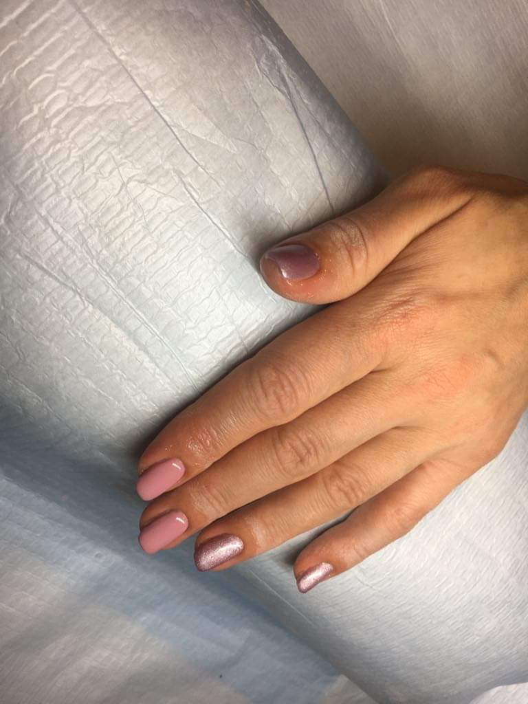 Izlivanje noktiju gelom - S dužina - Salon ljepote A3M By Amela Malkoč, Sarajevo Izlivanje noktiju Nokti Izlivanje noktiju, Sarajevo, Centar - Stari Grad