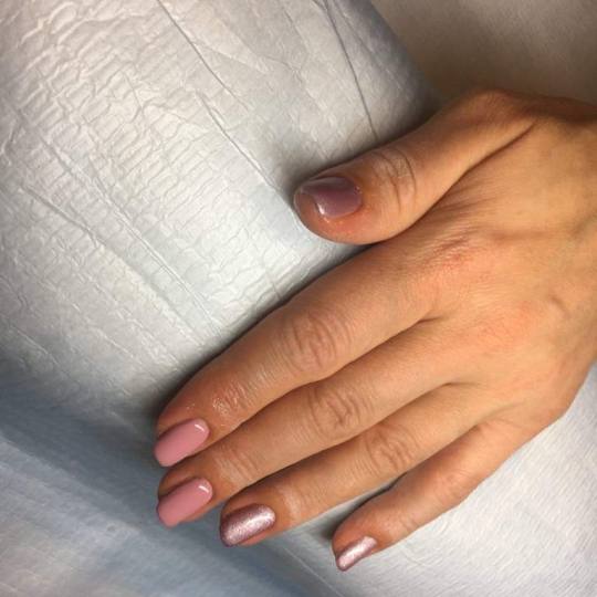 Salon ljepote A3M By Amela Malkoč #sarajevo Izlivanje noktiju Izlivanje noktiju gelom - S dužina �