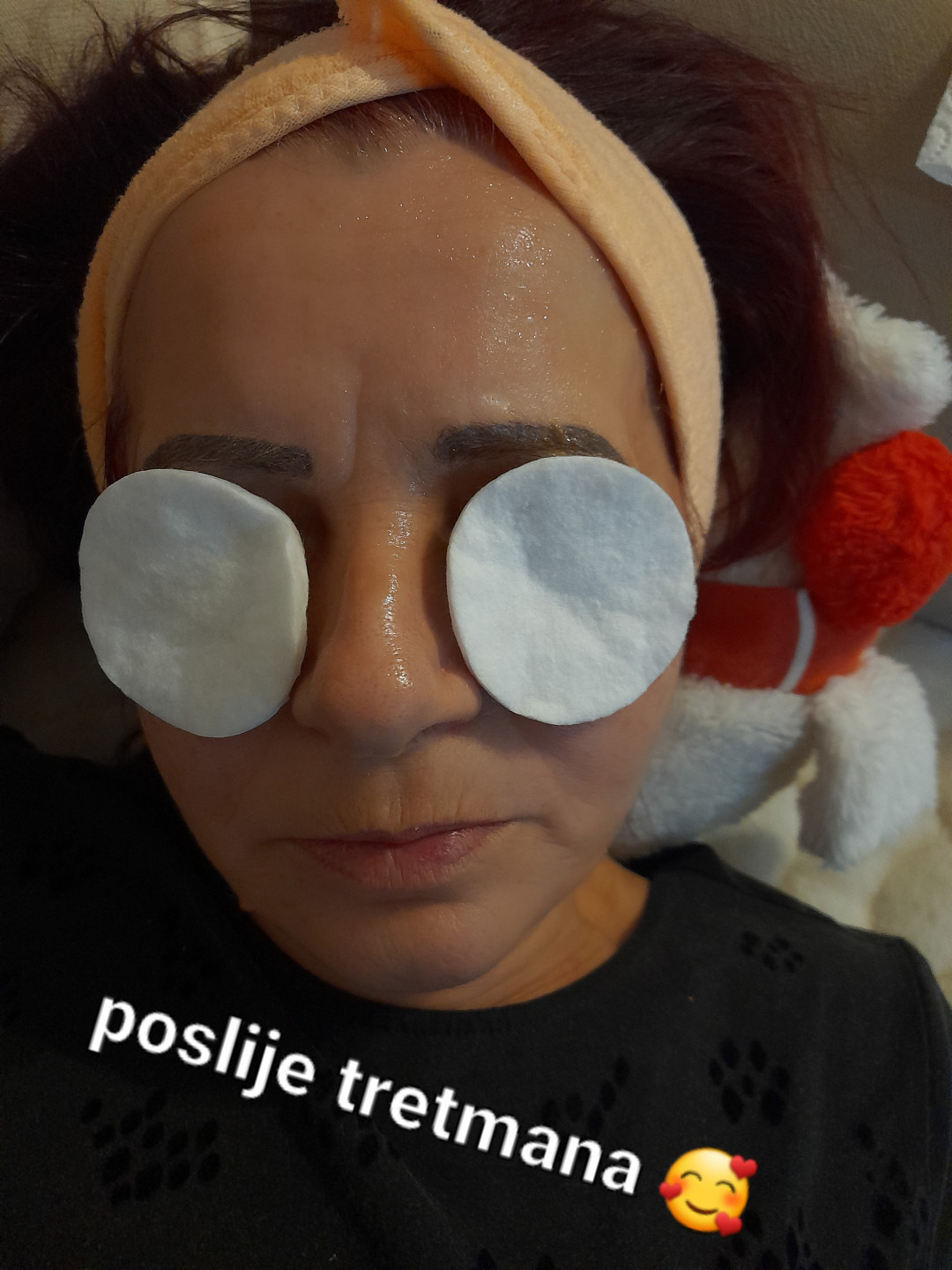 Tretman zlatnim + srebrnim nitima lice - Poezija ljepote, Sarajevo Ojačavanje noktiju Nokti Ojačavanje noktiju, Sarajevo, Novo Sarajevo - Novi Grad