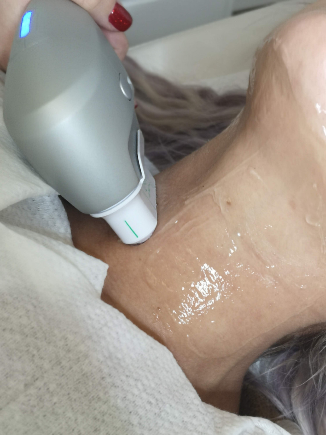 Elis Esthetic Studio #sarajevo Tretman lica