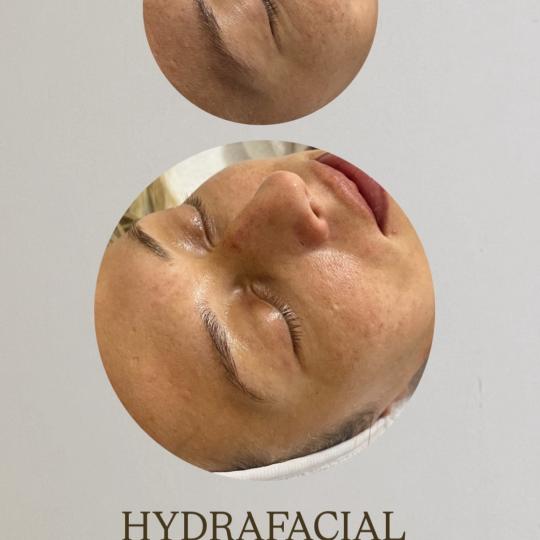 Hype Aesthetics Studio usluga