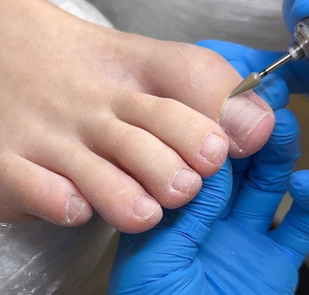 Poezija ljepote #sarajevo Estetski pedikir Ruska pedikura - bez laka