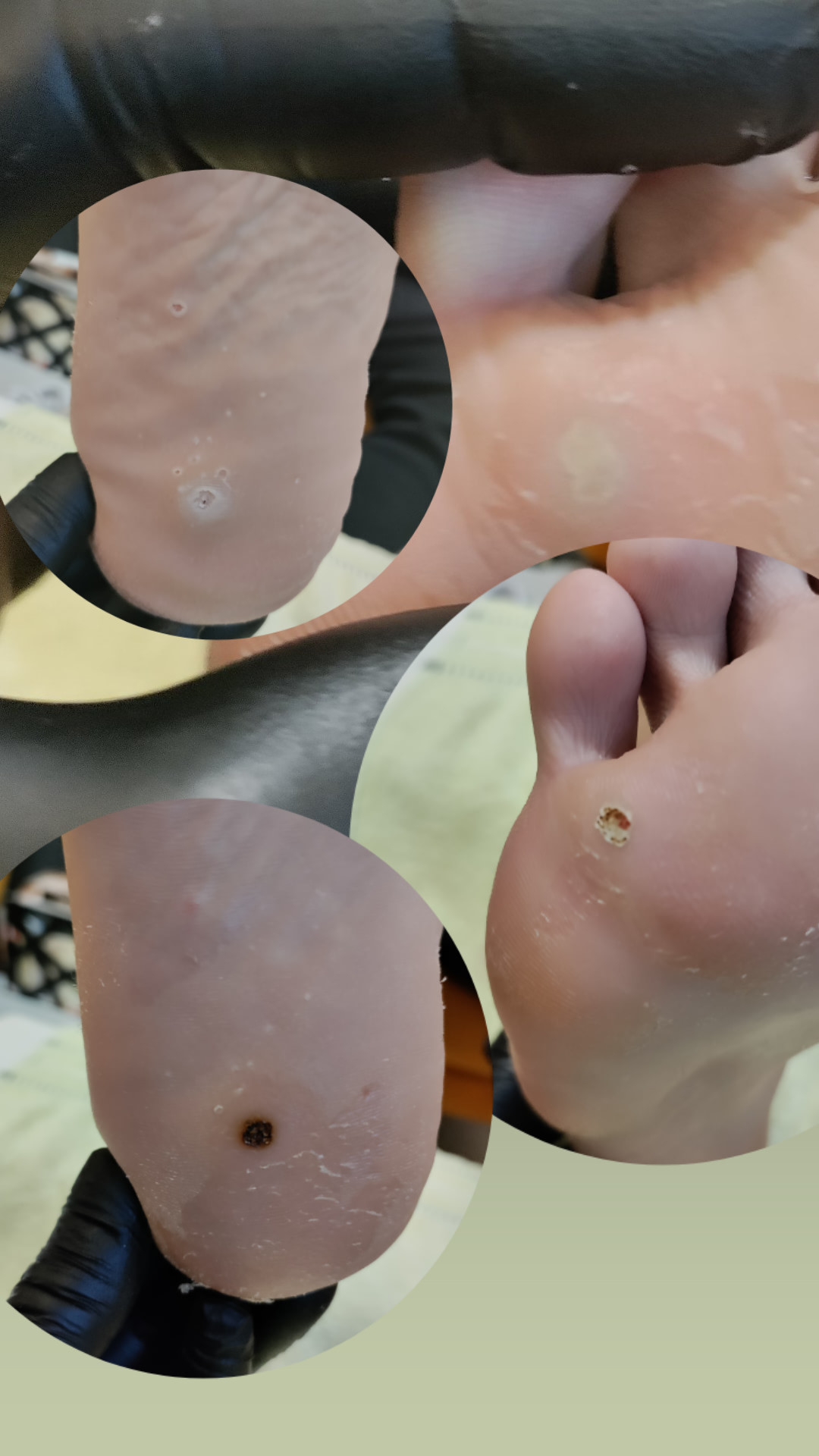 Kuća ljepote Djenna #sarajevo Medicinski pedikir Medicinski pedikir