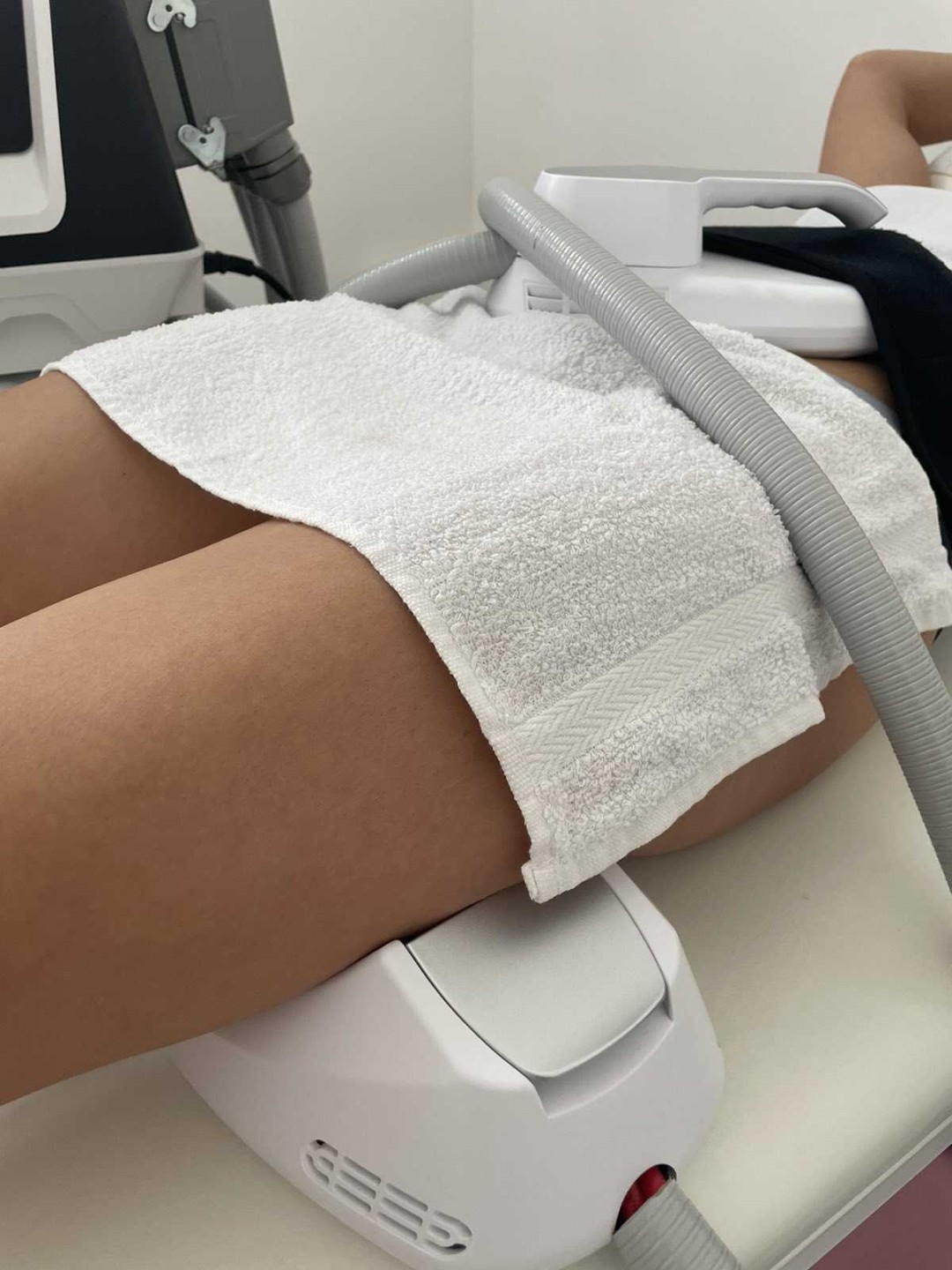 Signature #tuzla EMS trening EMS Sculpt - 4 sonde - paket od 8 tretmana