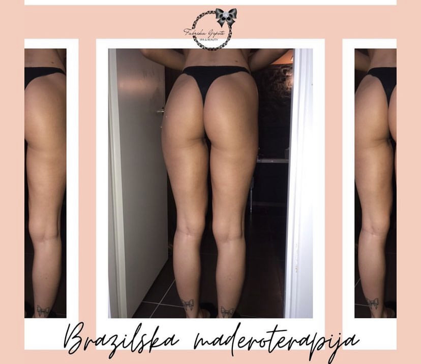 Brazilska maderoterapija paket - cijelo tijelo - Fabrika ljepote, Sarajevo Anticelulit masaža Masaža Anticelulit masaža, Sarajevo, Istočno Sarajevo