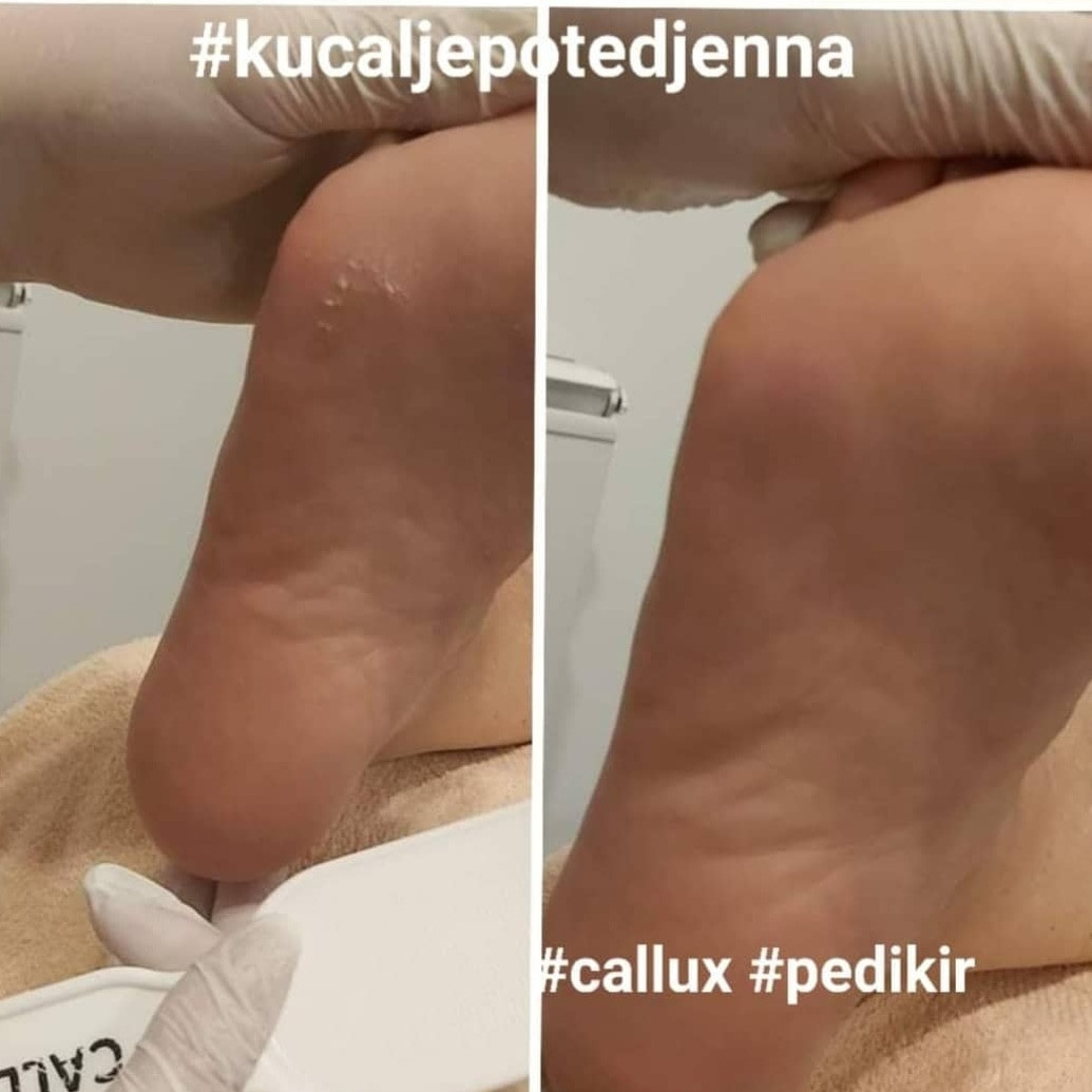 Kuća ljepote Djenna #sarajevo Estetski pedikir Callux pedikir