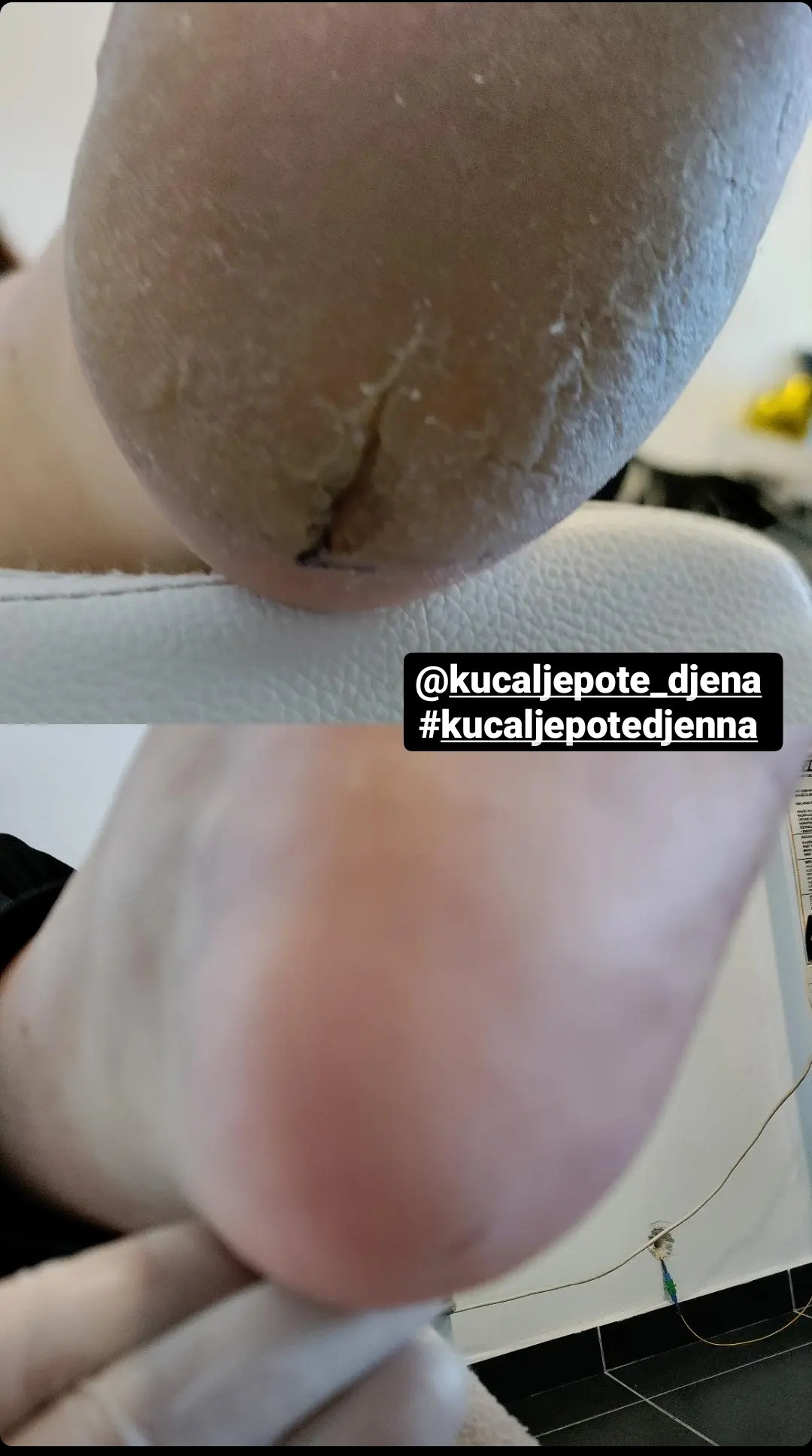 Kuća ljepote Djenna #sarajevo Estetski pedikir Callux pedikir