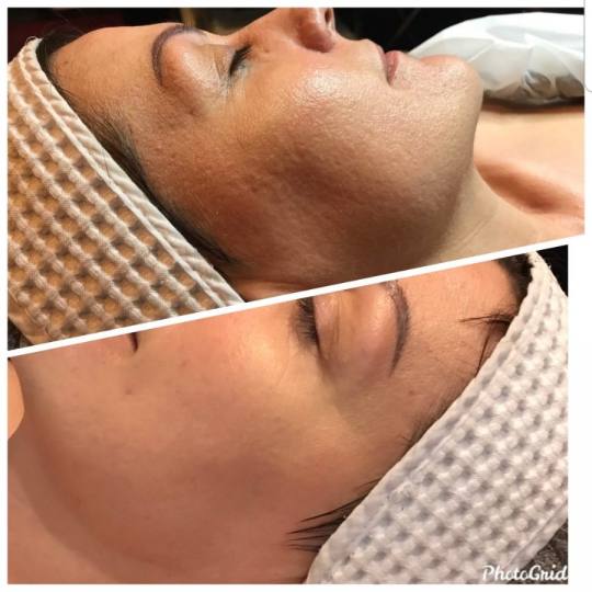 Vedrana #sarajevo Tretman lica Prije više od 60 godina, Christine Schrammek postavila je temelje or