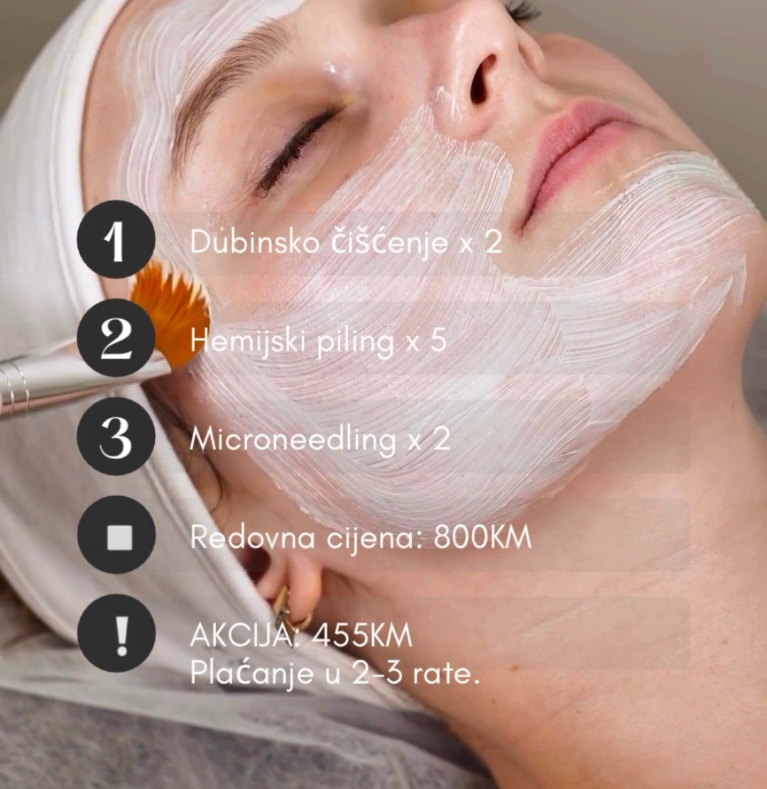 Fabrika ljepote #sarajevo Tretmani tijela Paket tretmana za ožiljke od akni