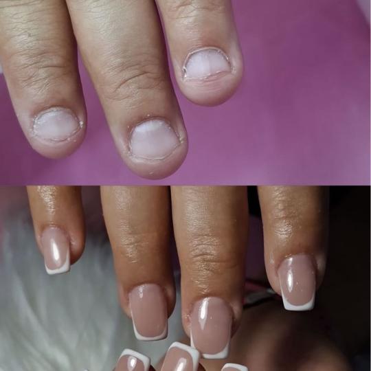 Poezija ljepote #sarajevo Nadogradnja noktiju Nadogradnja noktiju tipsama / izlivanje - S veličina