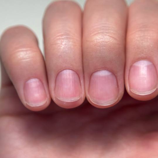 Lily Nails #sarajevo Francuski manikir i pedikir Manikura