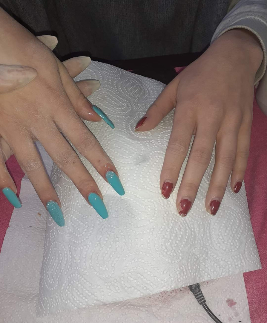 Shine - deaktivirano #sarajevo Izlivanje noktiju