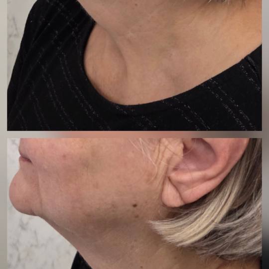 Angels Beauty - Banja Luka usluga