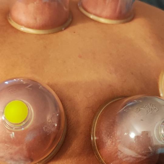 My Touch #sarajevo Tretmani tijela Hidžama Proces tretira izvlacenja neciste krvi iz organizma. Pre