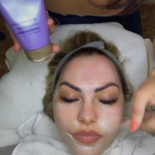 Studio Relax #kozarska-dubica Mikrodermoabrazija Mikrodermoabrazija + njega kože Mikrodermoabrazija