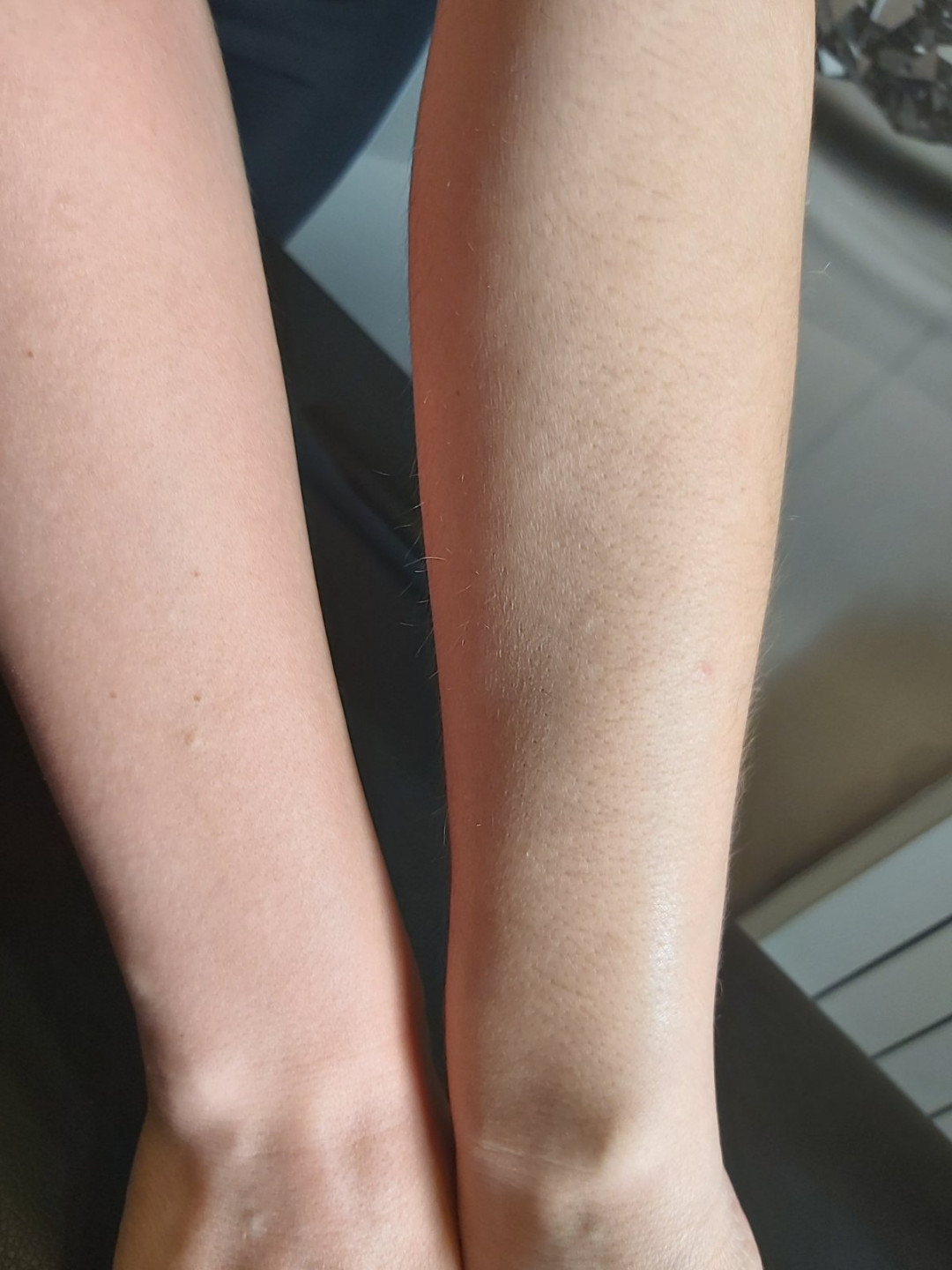 Kuća ljepote Djenna #sarajevo Depilacija šećernom pastom Depilacija ruku šećernom pastom