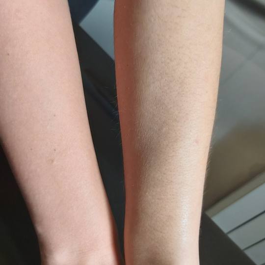 Kuća ljepote Djenna #sarajevo Depilacija šećernom pastom Depilacija ruku šećernom pastom