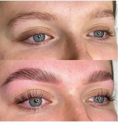 Signature #tuzla Obrve Edukacija - brow lift