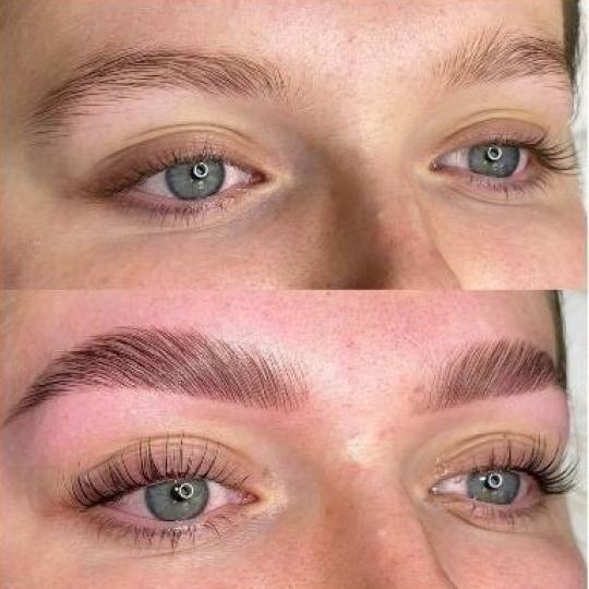 Signature #tuzla Obrve Edukacija - brow lift