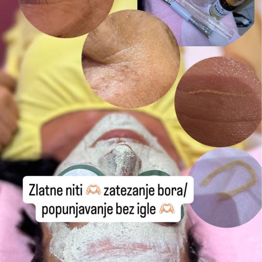 Poezija ljepote #sarajevo Ojačavanje noktiju Tretman zlatnim + srebrnim nitima lice