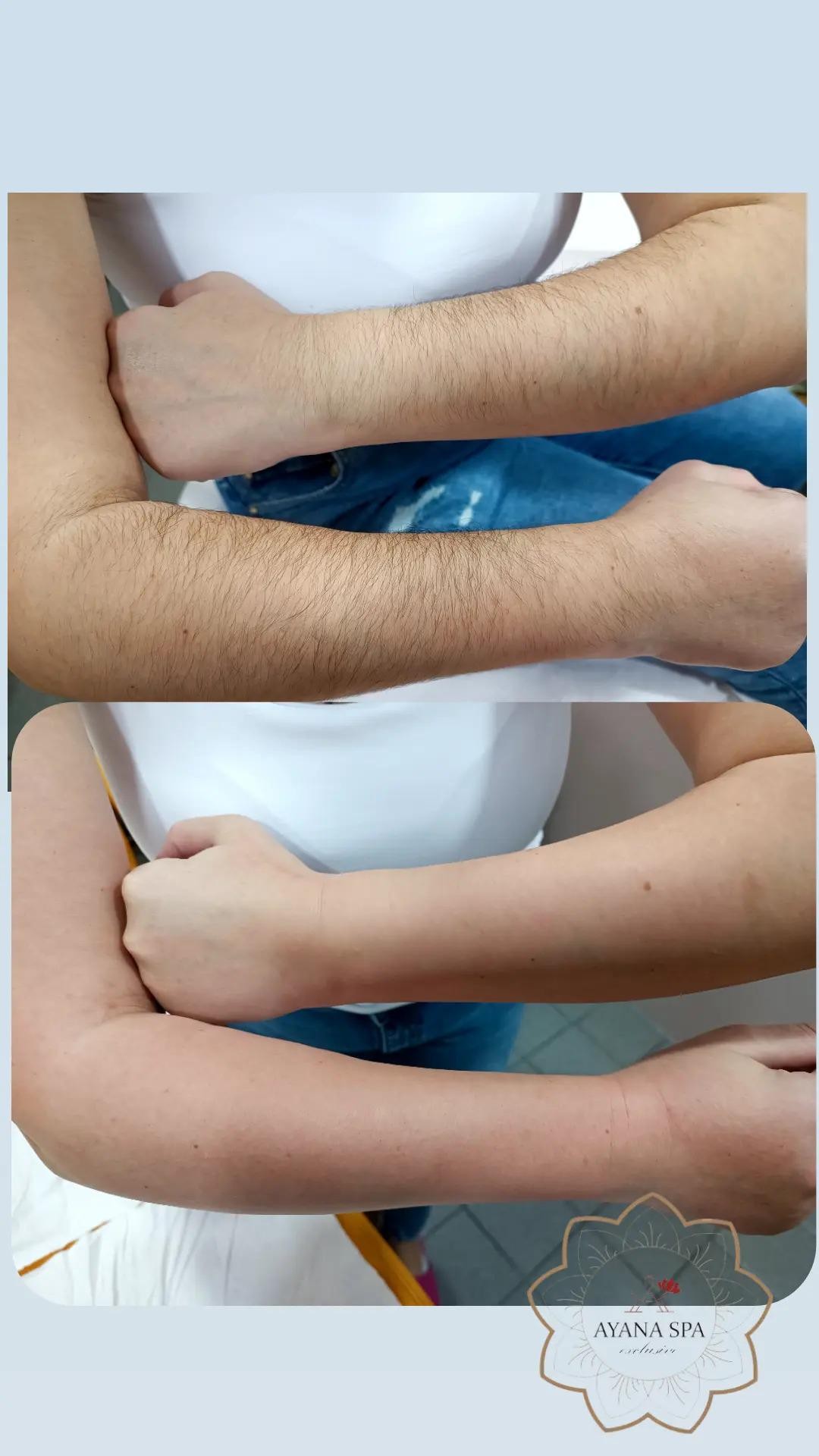 Ayana Spa #sarajevo Depilacija šećernom pastom Depilacija cijelih ruku šećernom pastom - za dame