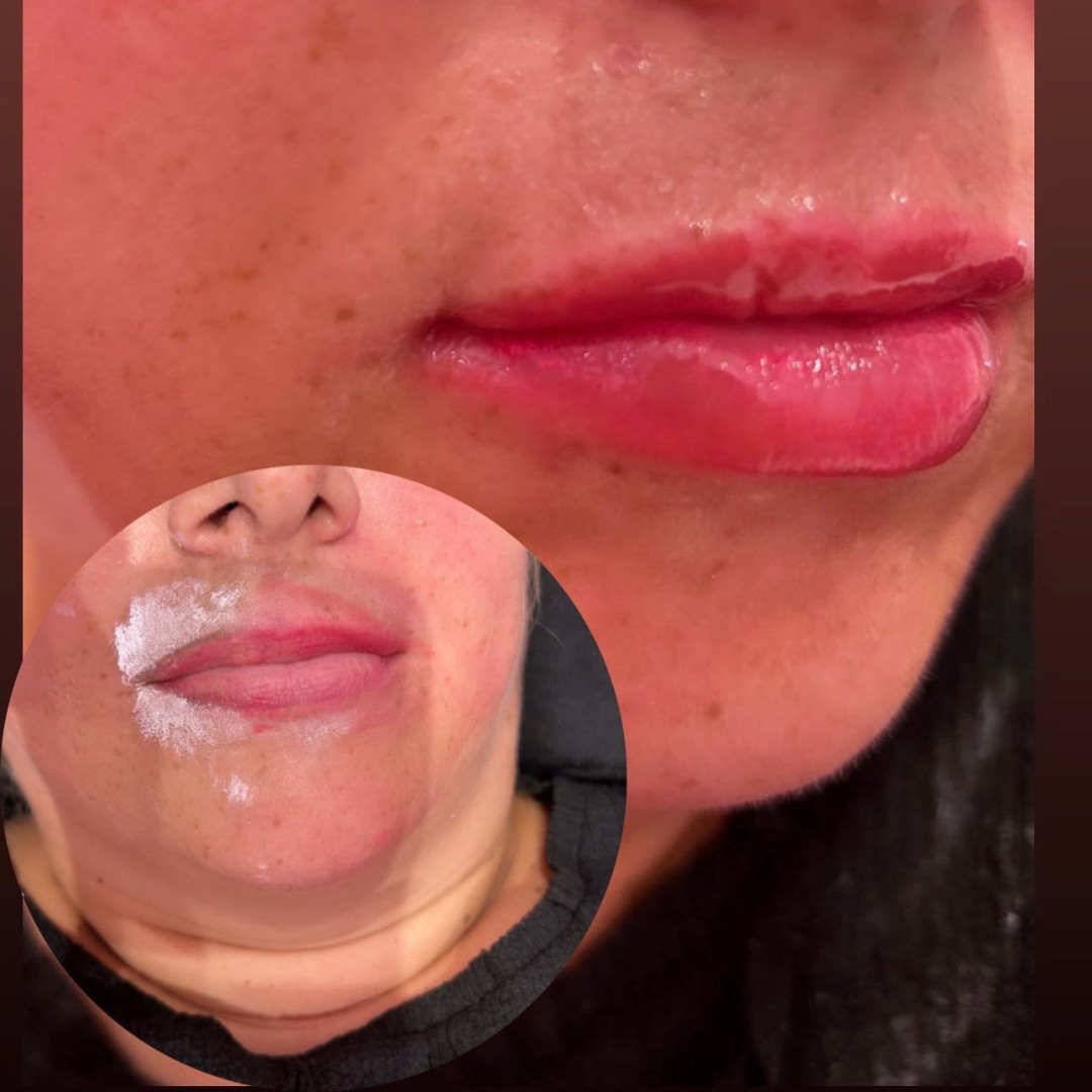 Poezija ljepote #sarajevo Trajna šminka Trajna šminka - usne