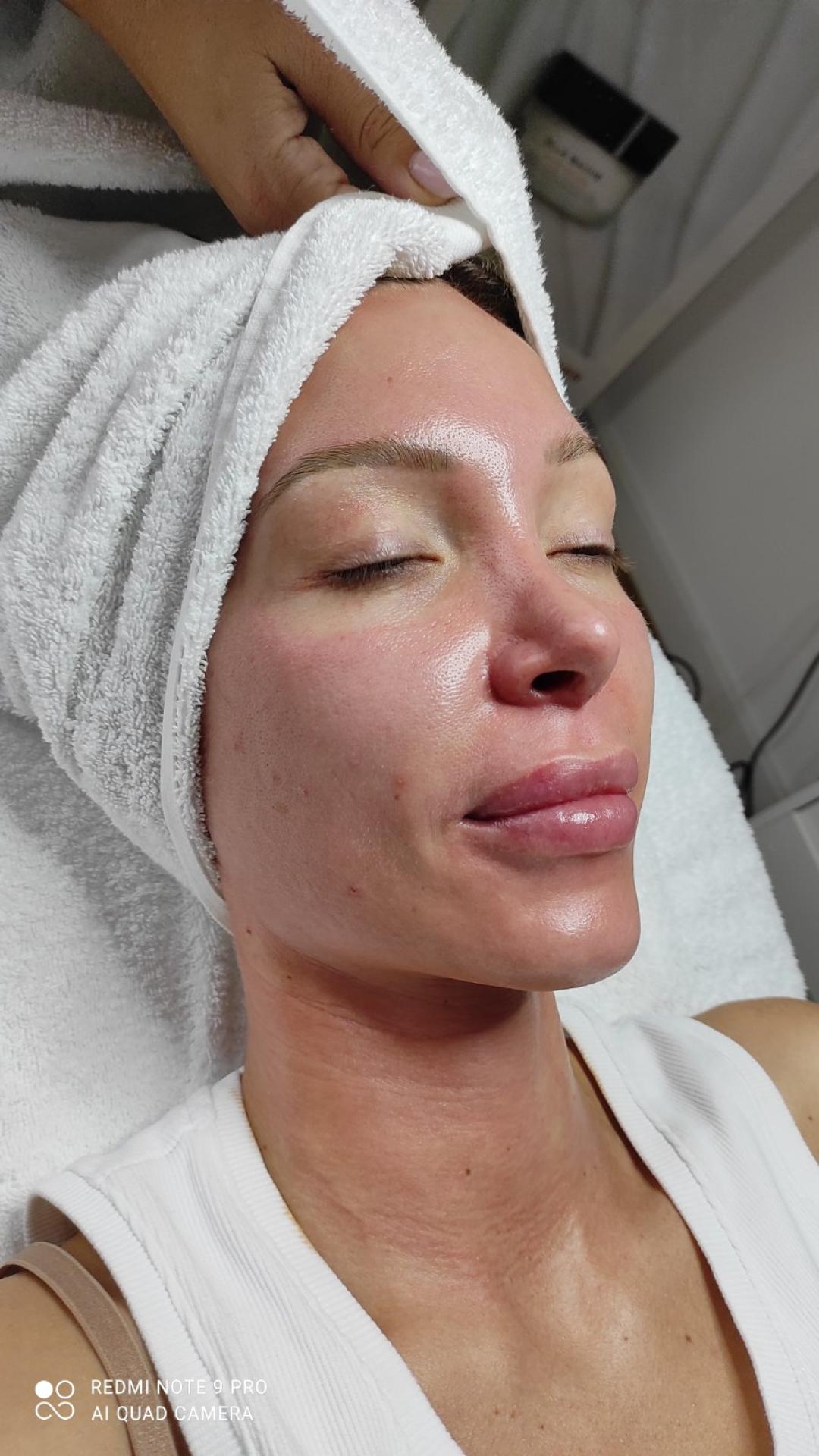 Ella Baché spa tretman lica + vrata - Delta M, Brčko Tretman lica Lice Tretman lica, Brčko, Centar