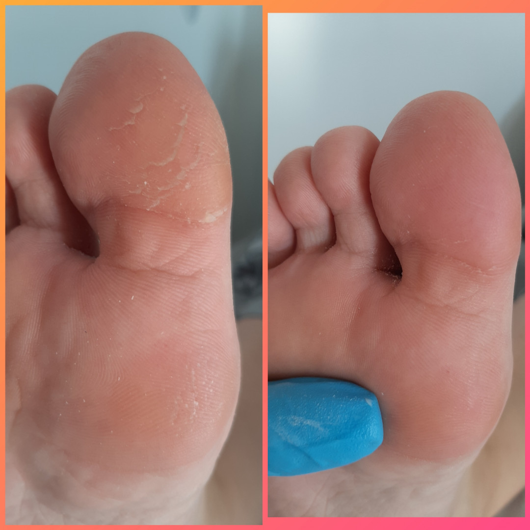 Kuća ljepote Djenna #sarajevo Estetski pedikir Callux pedikir