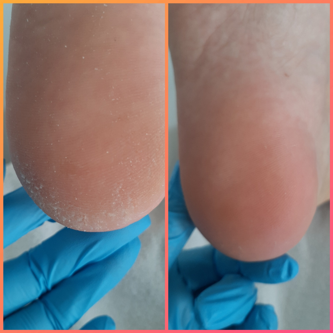 Kuća ljepote Djenna #sarajevo Estetski pedikir Callux pedikir