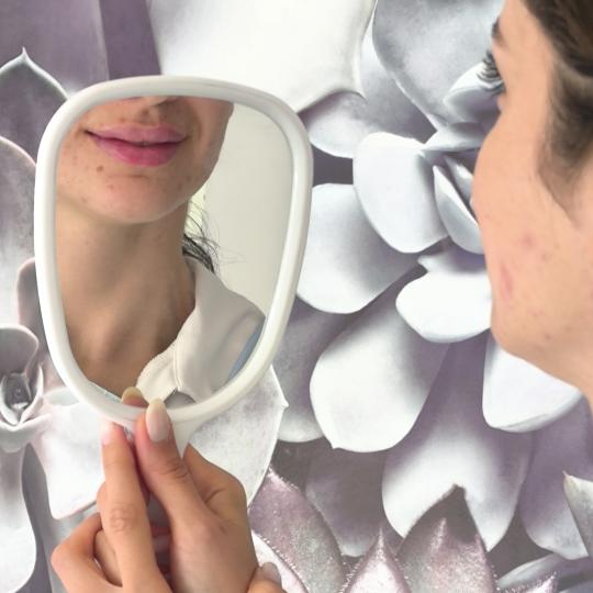 Estetika Janković #banjaluka Tretman lica Hijaluronski filer - 1 ml Korekcija usana hijaluronom