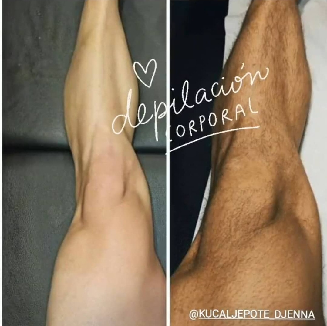 Kuća ljepote Djenna #sarajevo Depilacija šećernom pastom Depilacija nogu šećernom pastom