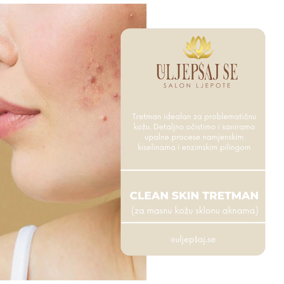 Uljepšaj se #sarajevo Tretman lica Clean skin tretman lica