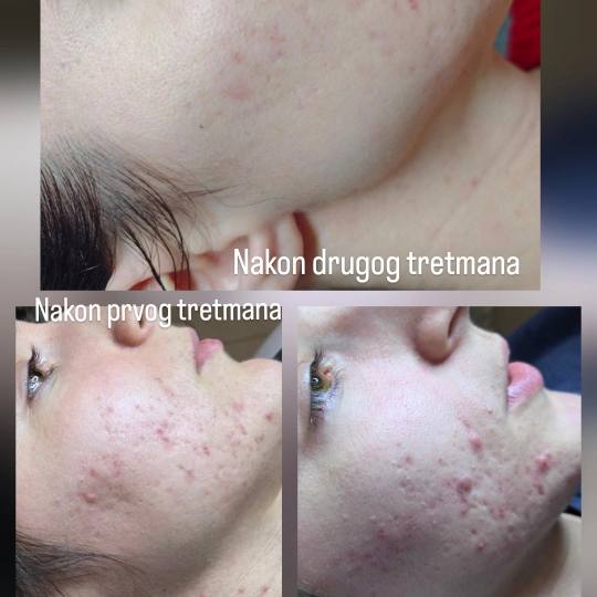 Angels Beauty - Banja Luka usluga