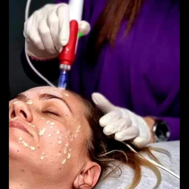 BB Glow - Poezija ljepote, Sarajevo Tretman lica Lice Tretman lica, Sarajevo, Novo Sarajevo - Novi Grad