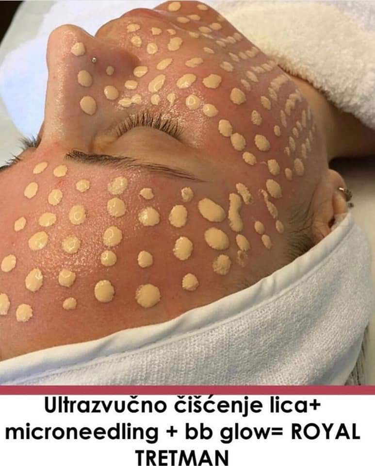 Sandra #visoko Tretman lica BB Glow - tretman lica