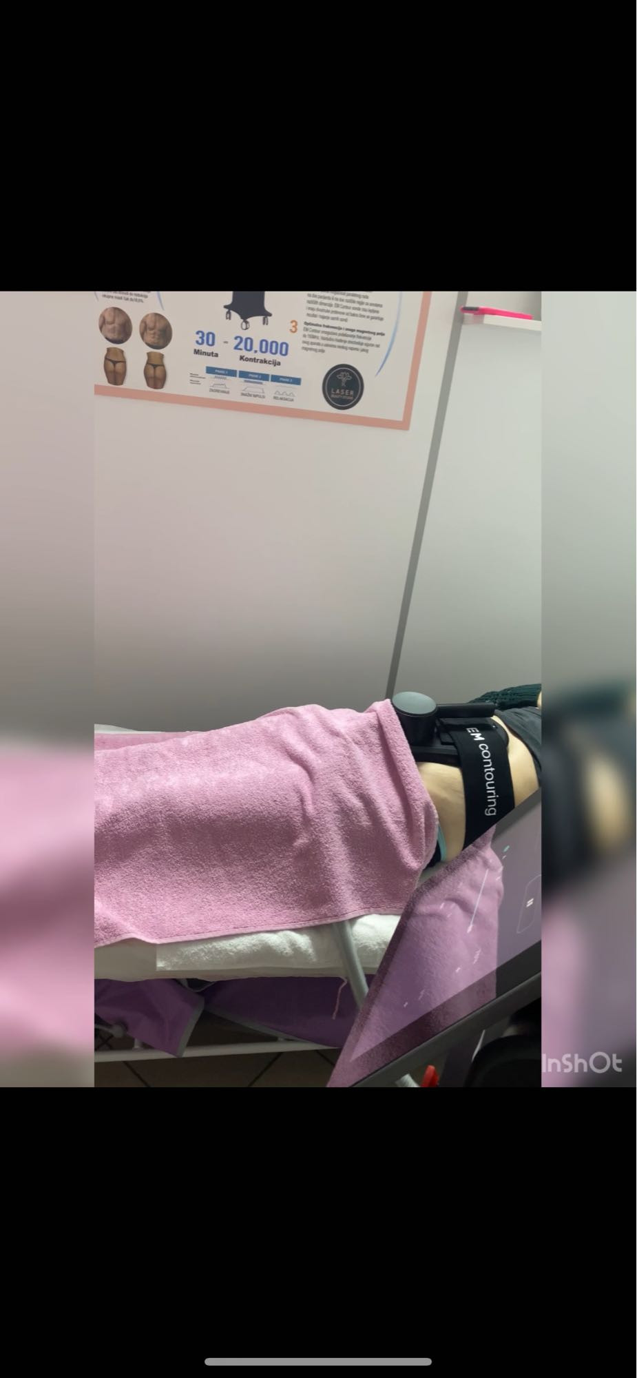 Laser Beauty Studio #visoko Tretman lica Stimulacija i definicija mišića 1 sonda - paket od 8 tretmana