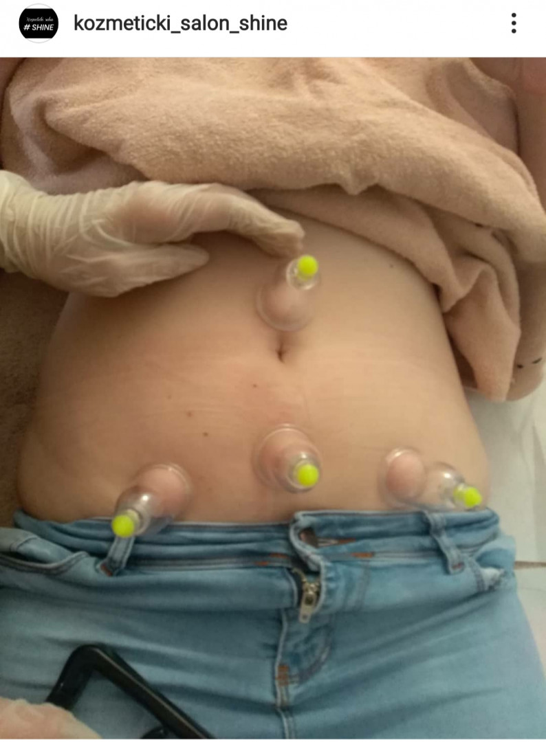 Shine - deaktivirano #sarajevo Masaža za opuštanje / relax / antistres