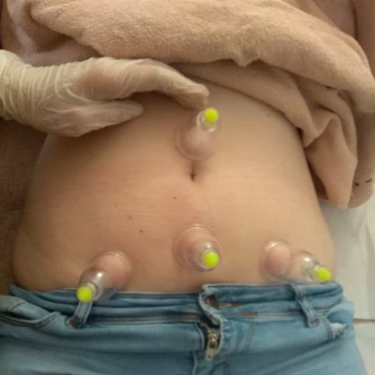 Shine - deaktivirano #sarajevo Masaža za opuštanje / relax / antistres