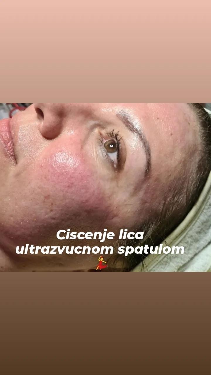 Poezija ljepote #sarajevo Tretman lica Klasično čišćenje lica