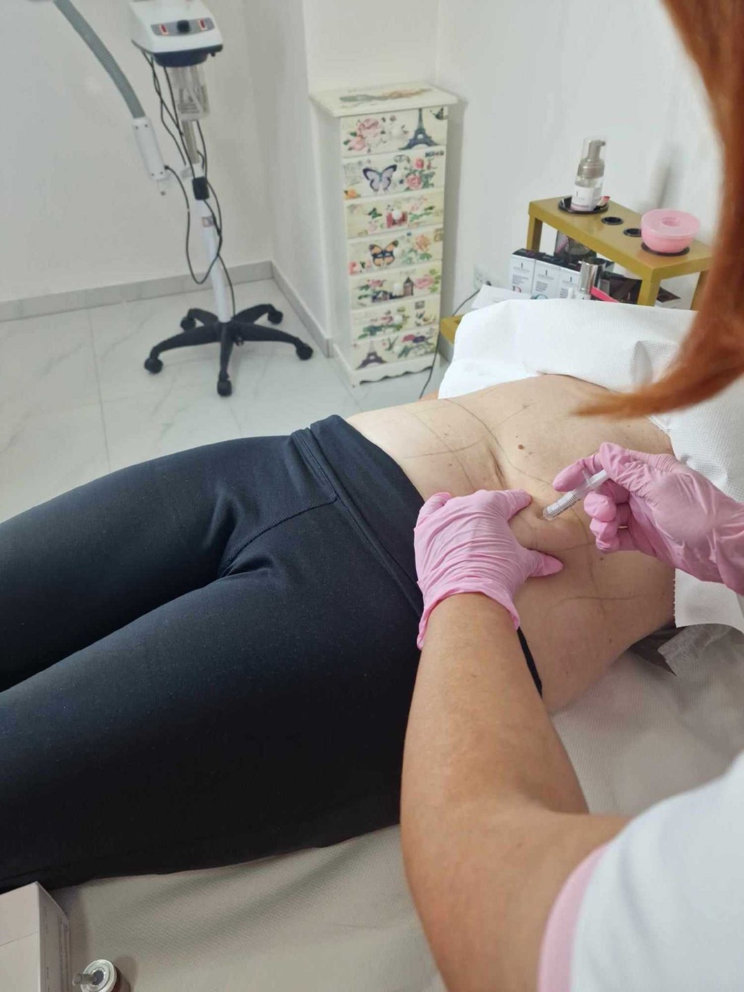 Signature #tuzla Tretmani tijela Lipoliza 10 ml